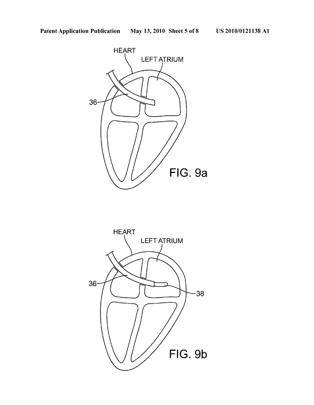 APPARATUS AND METHOD FOR SENSING FORCE - diagram, schematic, and image 06