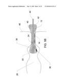 Devices and Methods for Monitoring Core Temperature and an Intraperitoneal Parameter diagram and image