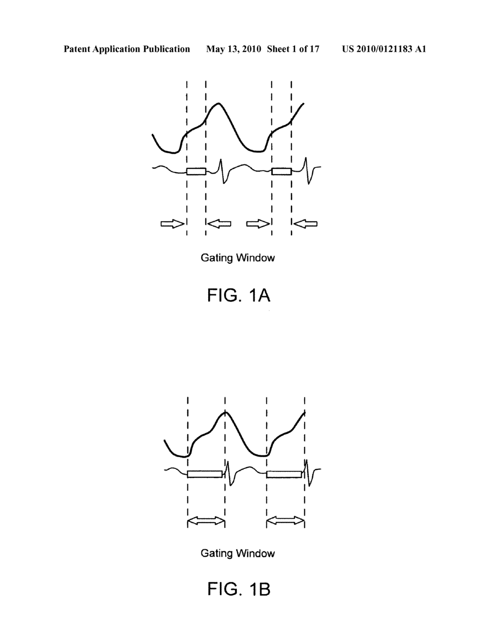 METHODS FOR MOTION COMPENSATED IMAGE RECONSTRUCTION AND SYSTEM RELATED THERETO - diagram, schematic, and image 02