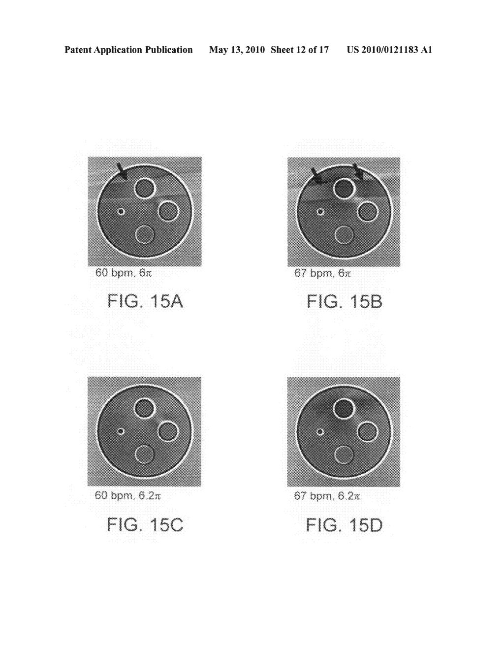 METHODS FOR MOTION COMPENSATED IMAGE RECONSTRUCTION AND SYSTEM RELATED THERETO - diagram, schematic, and image 13