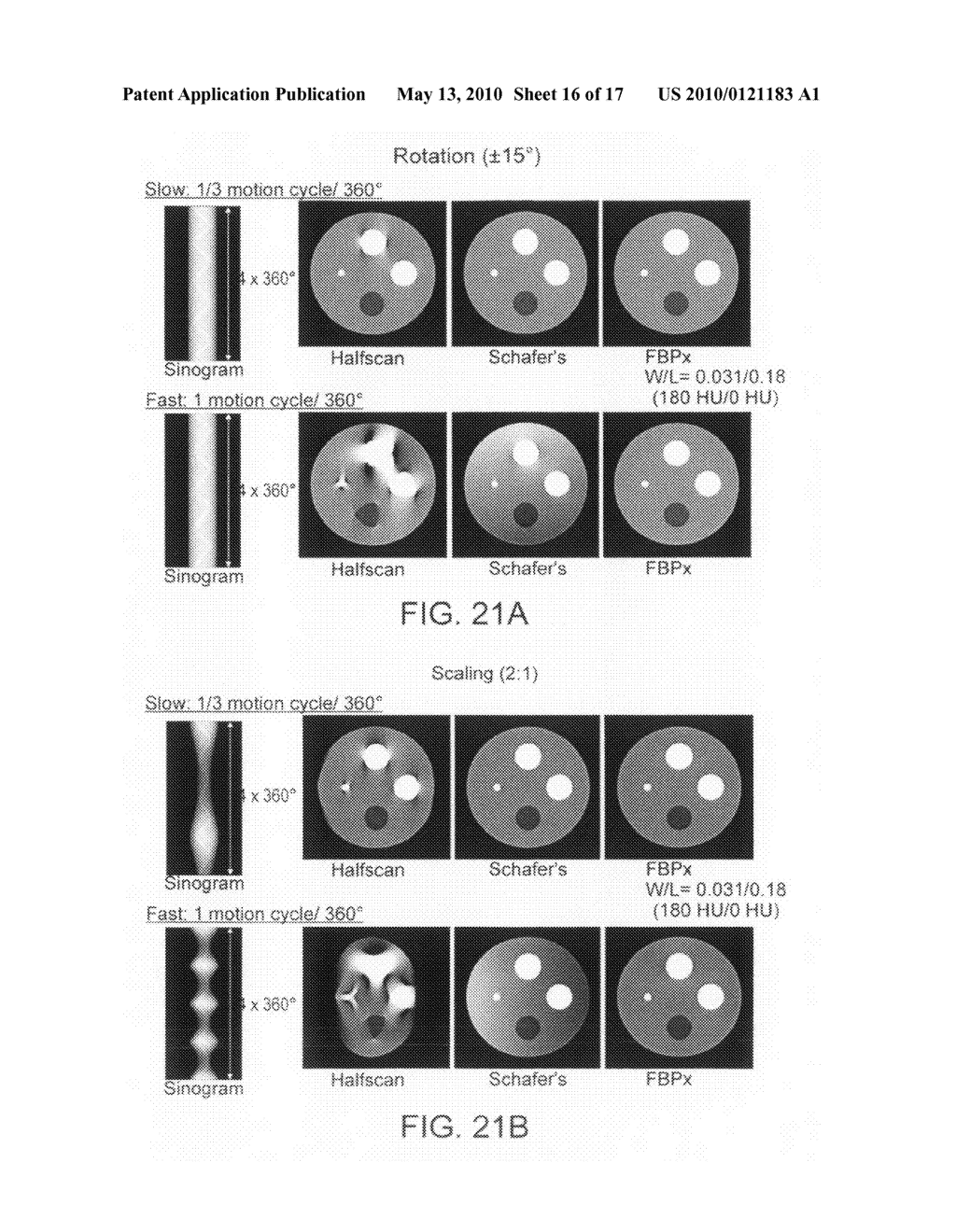 METHODS FOR MOTION COMPENSATED IMAGE RECONSTRUCTION AND SYSTEM RELATED THERETO - diagram, schematic, and image 17