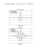 ULTRASONIC PERIODONTAL SYSTEM AND METHOD OF USING diagram and image