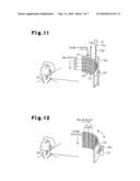 METHOD FOR IMAGING BLOOD VESSEL, SYSTEM FOR IMAGING BLOOD VESSEL AND PROGRAM FOR IMAGING BLOOD VESSEL diagram and image