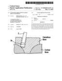 ULTRASONIC HORN WITH ENLARGED DISTAL END PORTION diagram and image