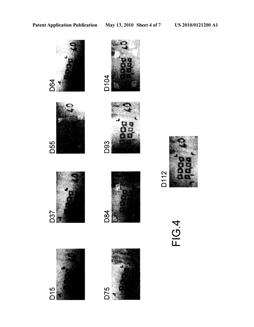 DIAGNOSTIC AND PROGNOSTIC ASSISTANCE DEVICE FOR PHYSIOPATHOLOGICAL TISSUE CHANGES - diagram, schematic, and image 05