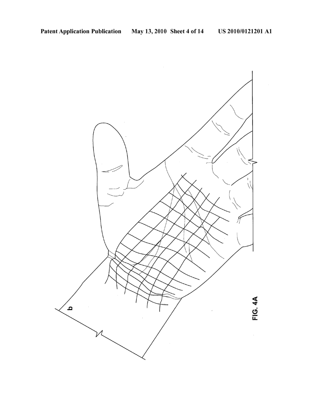 Non-invasive wound prevention, detection, and analysis - diagram, schematic, and image 05