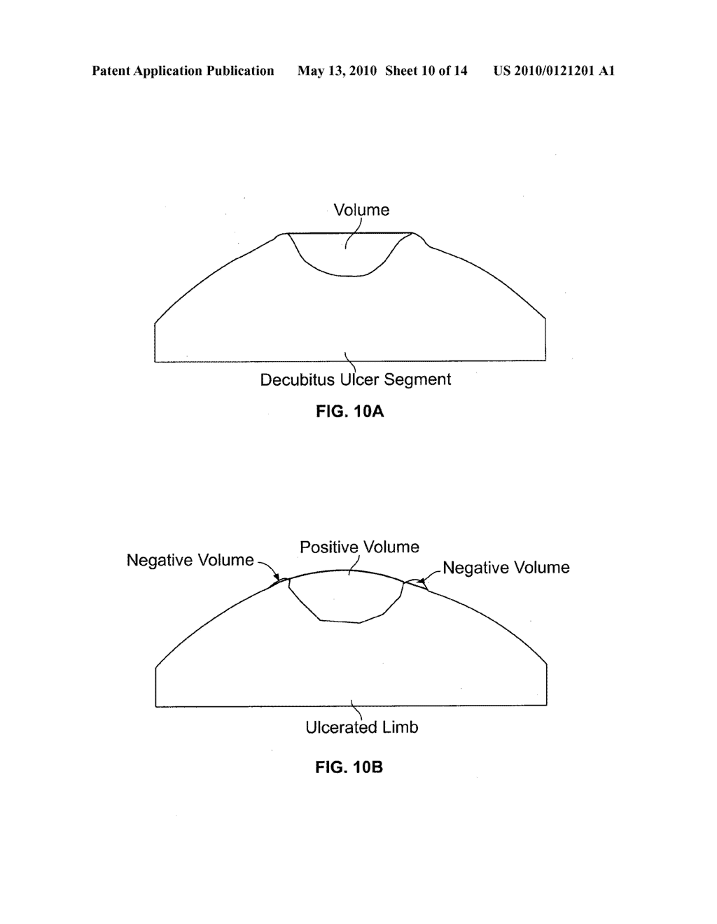 Non-invasive wound prevention, detection, and analysis - diagram, schematic, and image 11