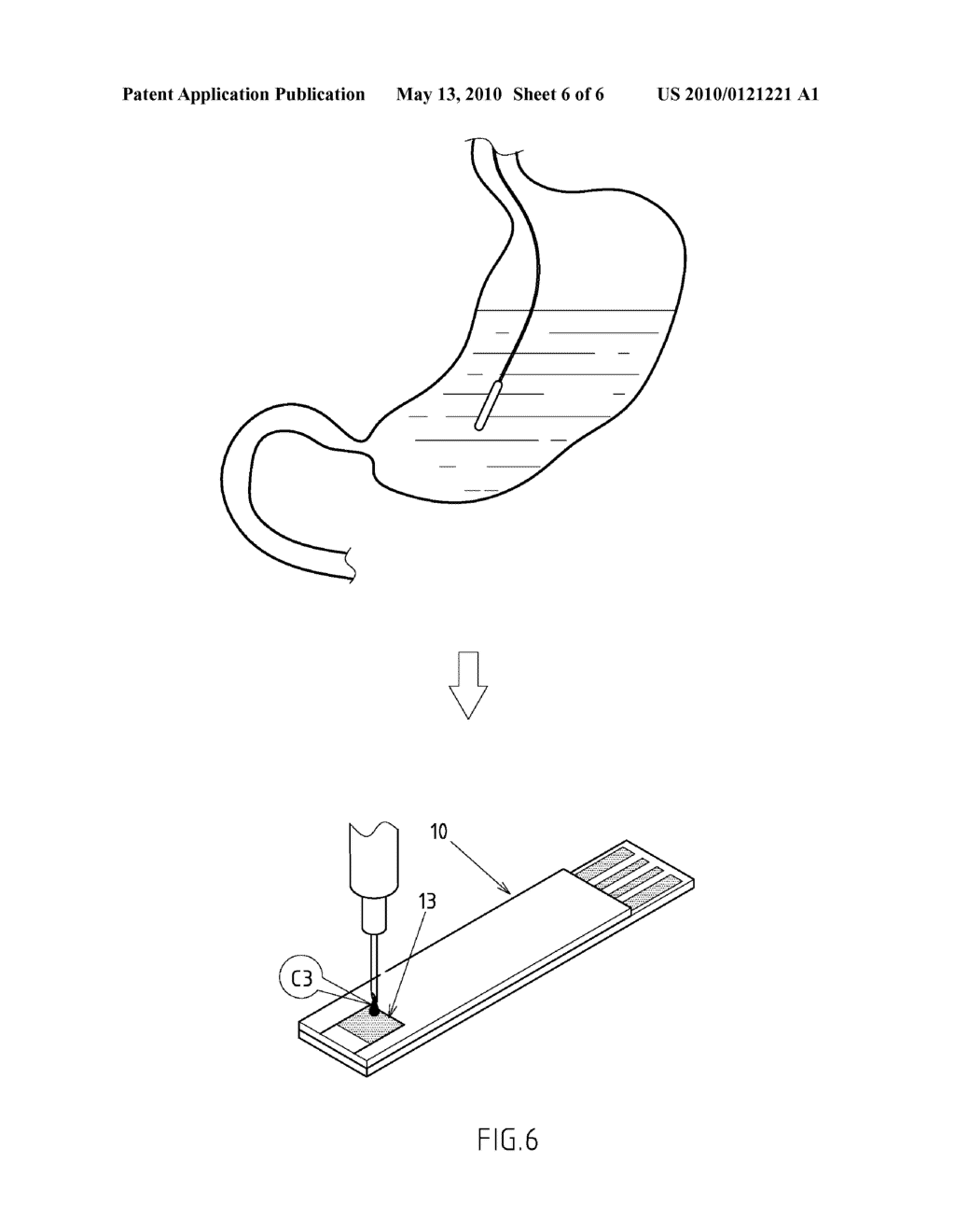 MEASURING DEVICE AND METHOD OF USING THE DEVICE TO MEASURE CONCENTRATION OF INTRAGASTRIC CONTENTS - diagram, schematic, and image 07