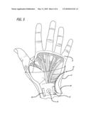 WRIST BRACE AND METHOD FOR ALLEVIATING AND PREVENTING WRIST PAIN diagram and image