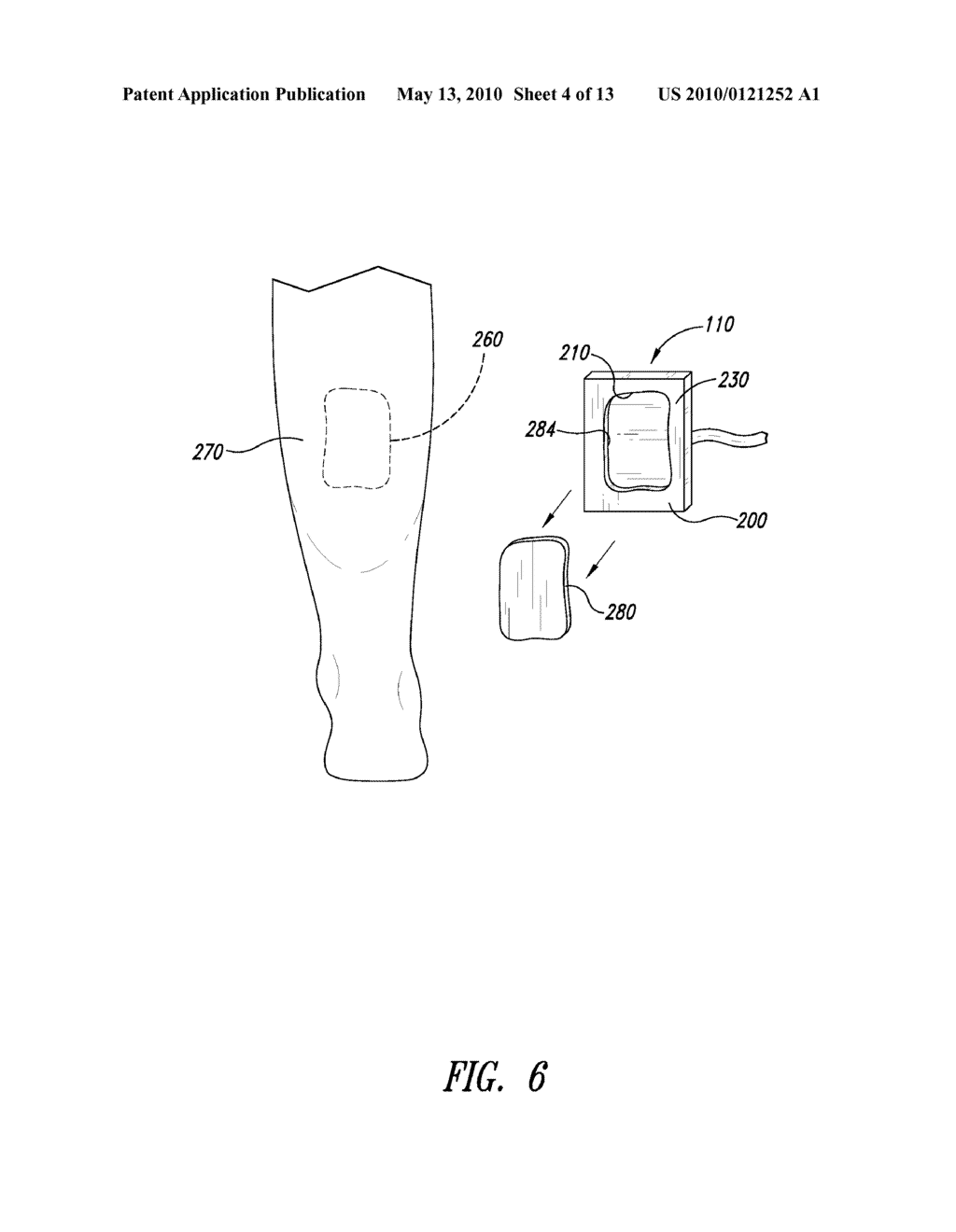 NON-INVASIVE VASCULAR TREATMENT SYSTEMS, DEVICES, AND METHODS OF USING THE SAME - diagram, schematic, and image 05