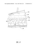 NON-INVASIVE VASCULAR TREATMENT SYSTEMS, DEVICES, AND METHODS OF USING THE SAME diagram and image