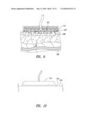 NON-INVASIVE VASCULAR TREATMENT SYSTEMS, DEVICES, AND METHODS OF USING THE SAME diagram and image