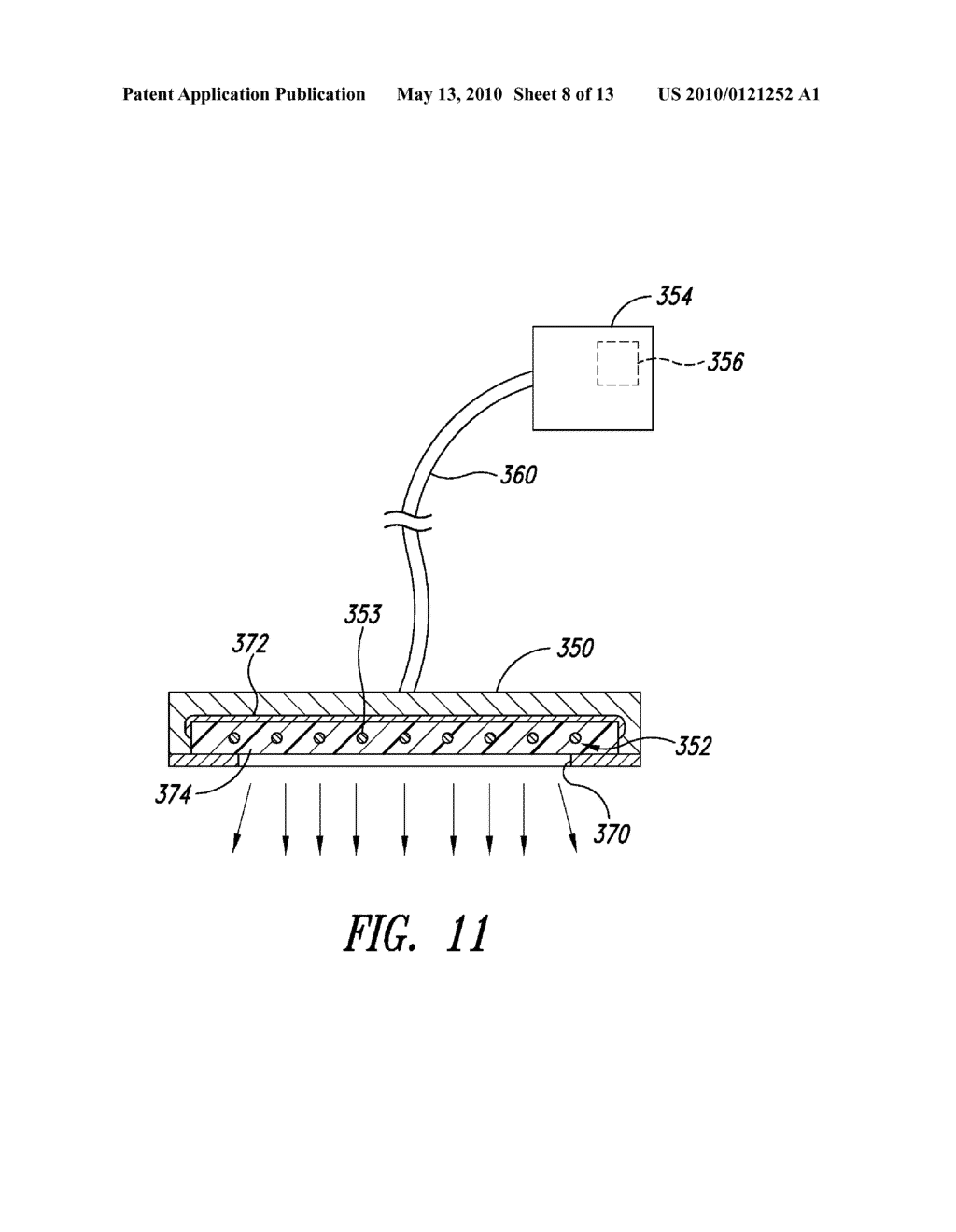 NON-INVASIVE VASCULAR TREATMENT SYSTEMS, DEVICES, AND METHODS OF USING THE SAME - diagram, schematic, and image 09