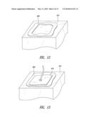 NON-INVASIVE VASCULAR TREATMENT SYSTEMS, DEVICES, AND METHODS OF USING THE SAME diagram and image