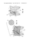 Method and Apparatus of Low Strength Electric Field Network-Mediated Delivery of Drug, Gene, SI-RNA, SH-RNA Protein, Peptide, Antibody or Other Biomedical and Therapeutic Molecules and Reagents in Solid Organs diagram and image