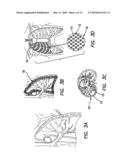 Method and Apparatus of Low Strength Electric Field Network-Mediated Delivery of Drug, Gene, SI-RNA, SH-RNA Protein, Peptide, Antibody or Other Biomedical and Therapeutic Molecules and Reagents in Solid Organs diagram and image