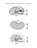 Method and Apparatus of Low Strength Electric Field Network-Mediated Delivery of Drug, Gene, SI-RNA, SH-RNA Protein, Peptide, Antibody or Other Biomedical and Therapeutic Molecules and Reagents in Solid Organs diagram and image