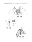 Method and Apparatus of Low Strength Electric Field Network-Mediated Delivery of Drug, Gene, SI-RNA, SH-RNA Protein, Peptide, Antibody or Other Biomedical and Therapeutic Molecules and Reagents in Solid Organs diagram and image