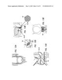 Method and Apparatus of Low Strength Electric Field Network-Mediated Delivery of Drug, Gene, SI-RNA, SH-RNA Protein, Peptide, Antibody or Other Biomedical and Therapeutic Molecules and Reagents in Solid Organs diagram and image