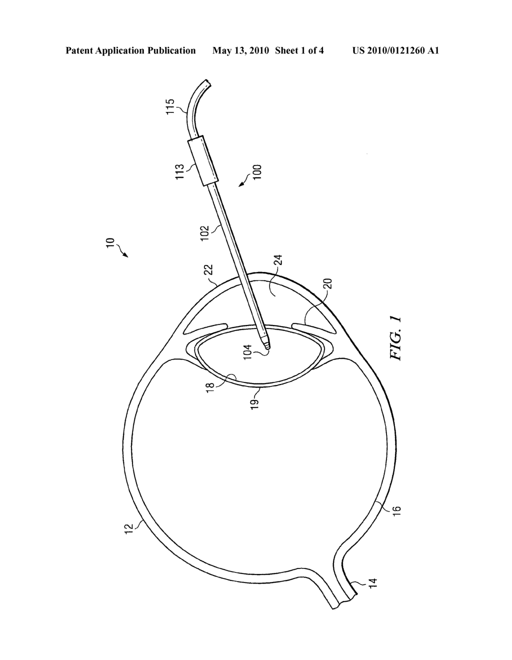 Distal Plastic End Infusion/Aspiration Tip - diagram, schematic, and image 02