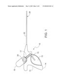 Anti-Adhesion Spraying diagram and image