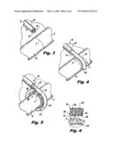 SUPER ELASTIC LOOP EXTRALUMINAL MATERIALS DELIVERY INSTRUMENT diagram and image