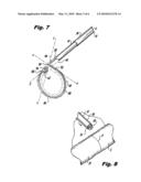 SUPER ELASTIC LOOP EXTRALUMINAL MATERIALS DELIVERY INSTRUMENT diagram and image