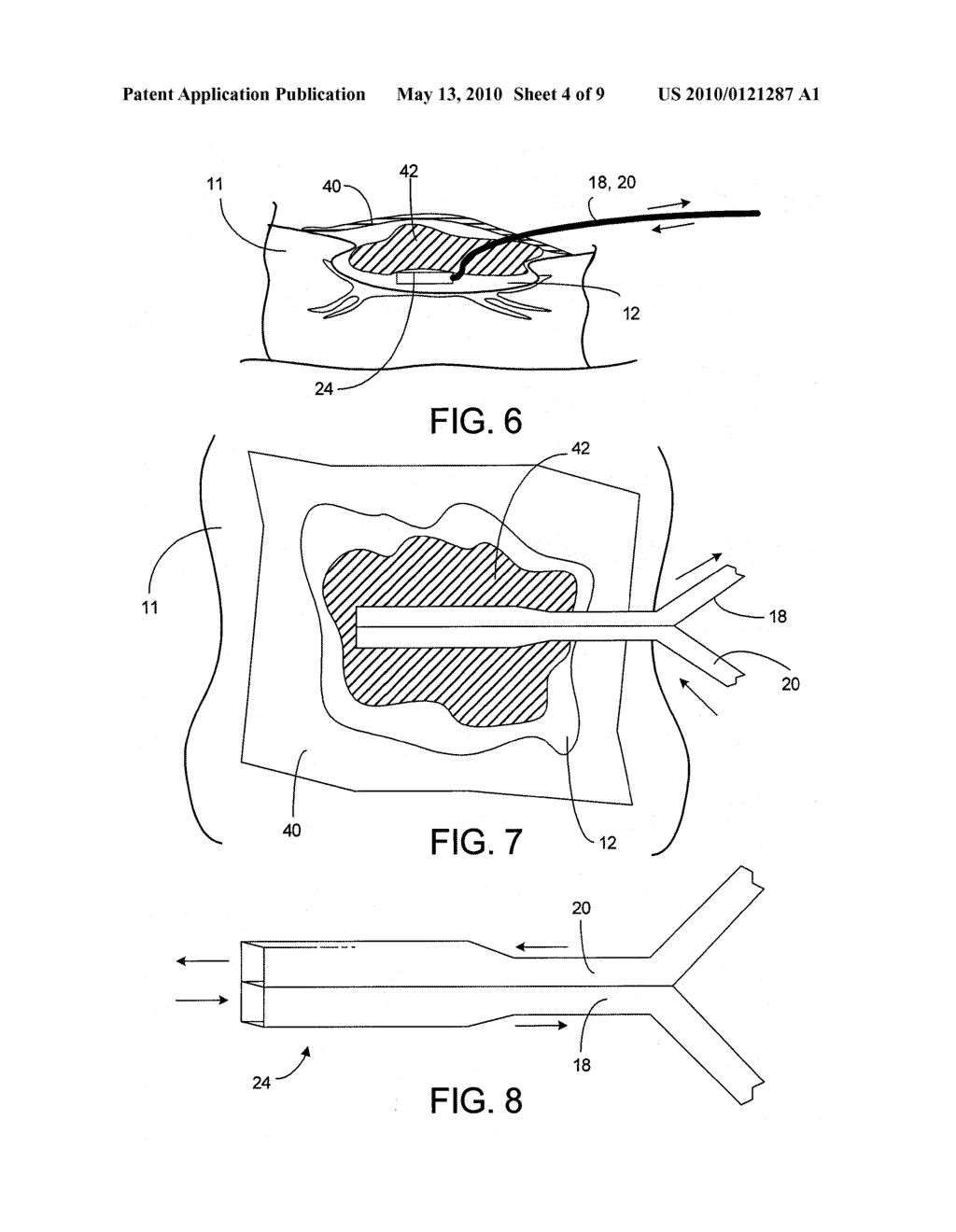 WOUND CARE SYSTEM - diagram, schematic, and image 05