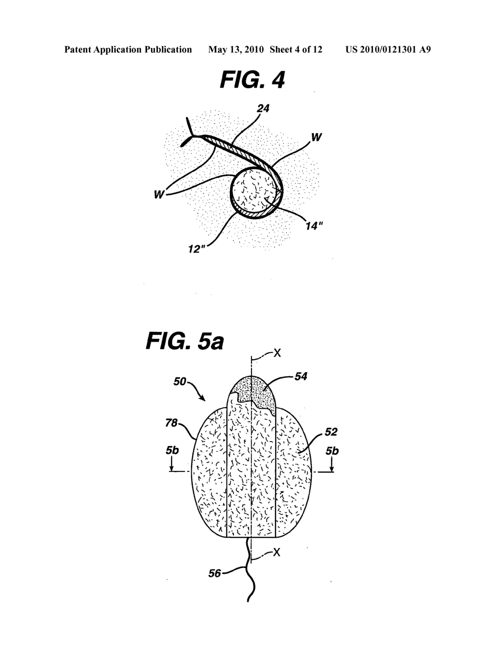 Method of using intravaginal device with fluid transport plates - diagram, schematic, and image 05