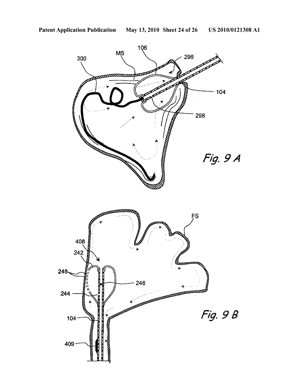 DEVICES AND METHODS FOR DELIVERING THERAPEUTIC SUBSTANCES FOR THE TREATMENT OF SINUSITIS AND OTHER DISORDERS - diagram, schematic, and image 25