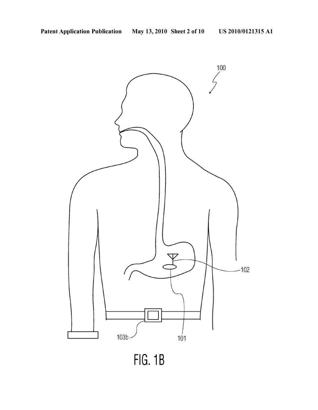 PERSONAL ACCESSORY FOR USE WITH A PILL - diagram, schematic, and image 03