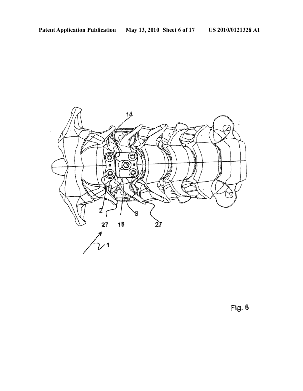 PLATE IMPLANT, IN PARTICULAR FOR USE ON A SPINAL COLUMN - diagram, schematic, and image 07