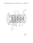 PLATE IMPLANT, IN PARTICULAR FOR USE ON A SPINAL COLUMN diagram and image