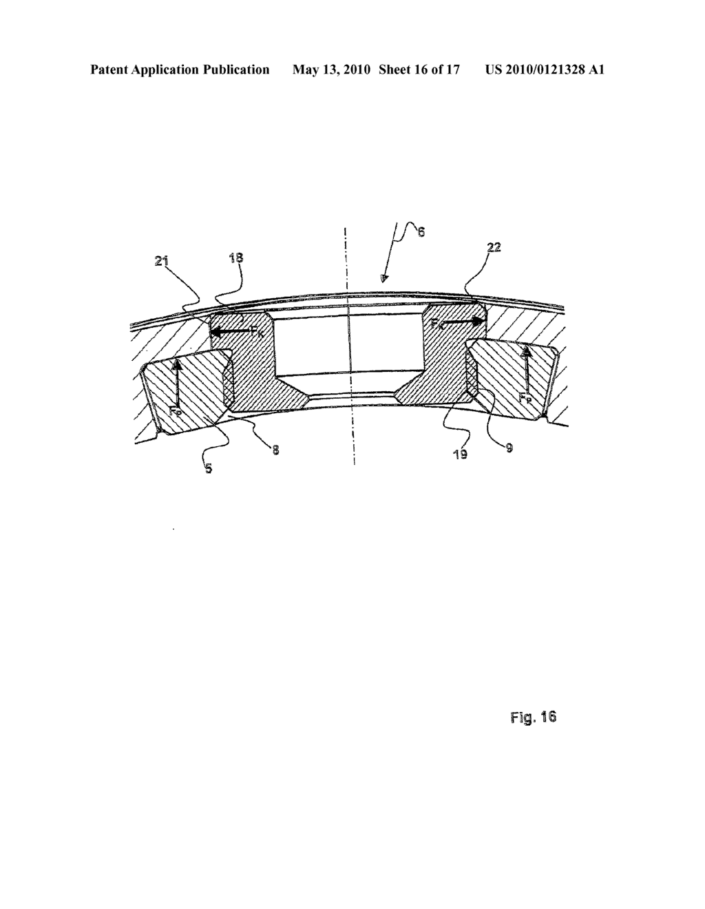 PLATE IMPLANT, IN PARTICULAR FOR USE ON A SPINAL COLUMN - diagram, schematic, and image 17