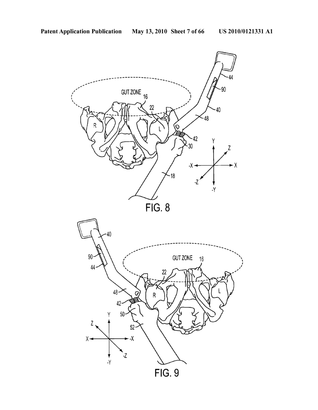 UNIVERSAL DOUBLE OFFSET SURGICAL INSTRUMENT - diagram, schematic, and image 08