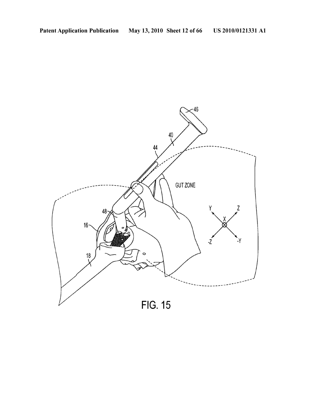 UNIVERSAL DOUBLE OFFSET SURGICAL INSTRUMENT - diagram, schematic, and image 13