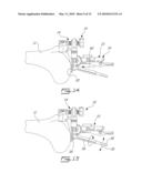 UNIVERSAL POSITIONING DEVICE FOR ORTHOPEDIC SURGERY AND METHOD OF USE THEREOF diagram and image