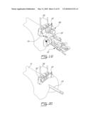 UNIVERSAL POSITIONING DEVICE FOR ORTHOPEDIC SURGERY AND METHOD OF USE THEREOF diagram and image