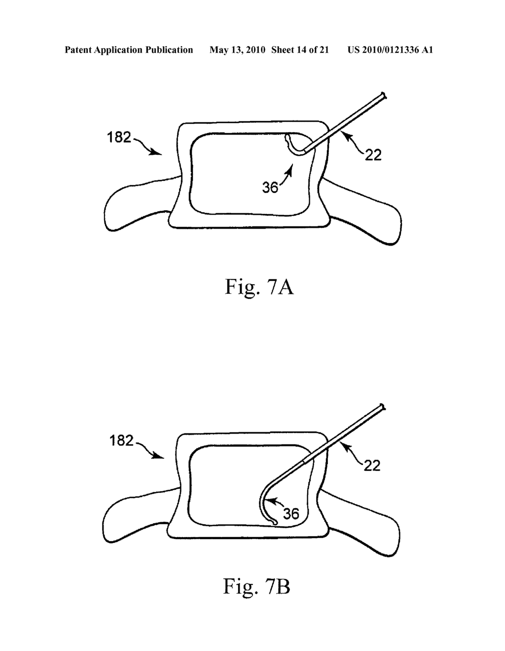 DEVICE, SYSTEM, AND METHOD FOR FORMING A CAVITY IN AND DELIVERING A CURABLE MATERIAL INTO BONE - diagram, schematic, and image 15