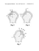 DEVICE FOR DRILLING ANGLED OSTEAL TUNNELS diagram and image