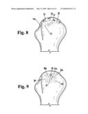 DEVICE FOR DRILLING ANGLED OSTEAL TUNNELS diagram and image