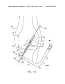 METHOD AND APPARATUS FOR FIXING A GRAFT IN A BONE TUNNEL diagram and image