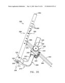 METHOD AND APPARATUS FOR FIXING A GRAFT IN A BONE TUNNEL diagram and image