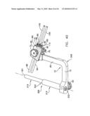 METHOD AND APPARATUS FOR FIXING A GRAFT IN A BONE TUNNEL diagram and image