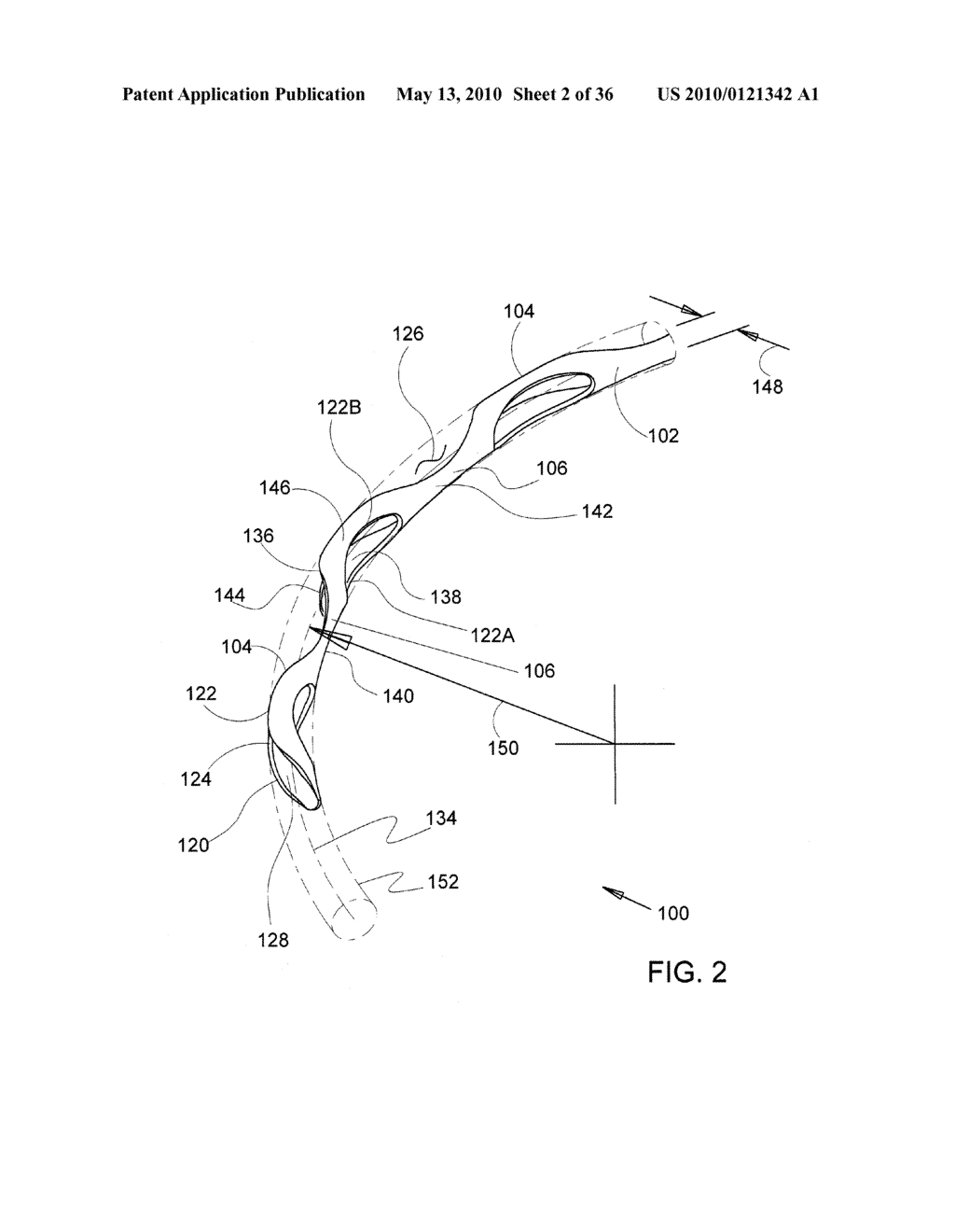 Methods and Apparatus for Delivering Ocular Implants Into the Eye - diagram, schematic, and image 03