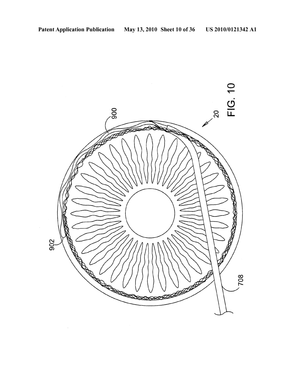 Methods and Apparatus for Delivering Ocular Implants Into the Eye - diagram, schematic, and image 11