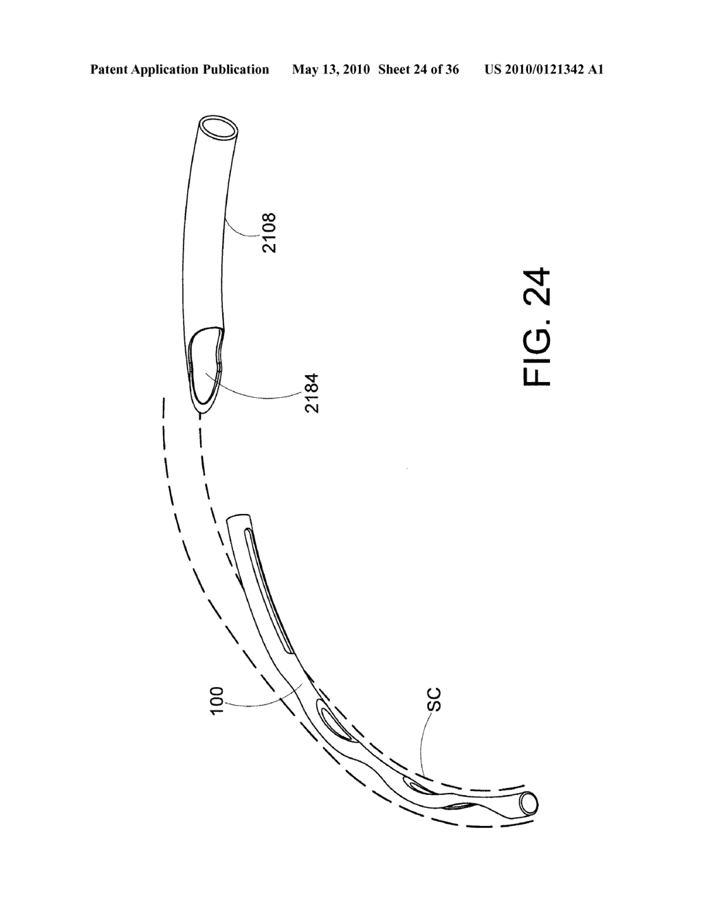 Methods and Apparatus for Delivering Ocular Implants Into the Eye - diagram, schematic, and image 25