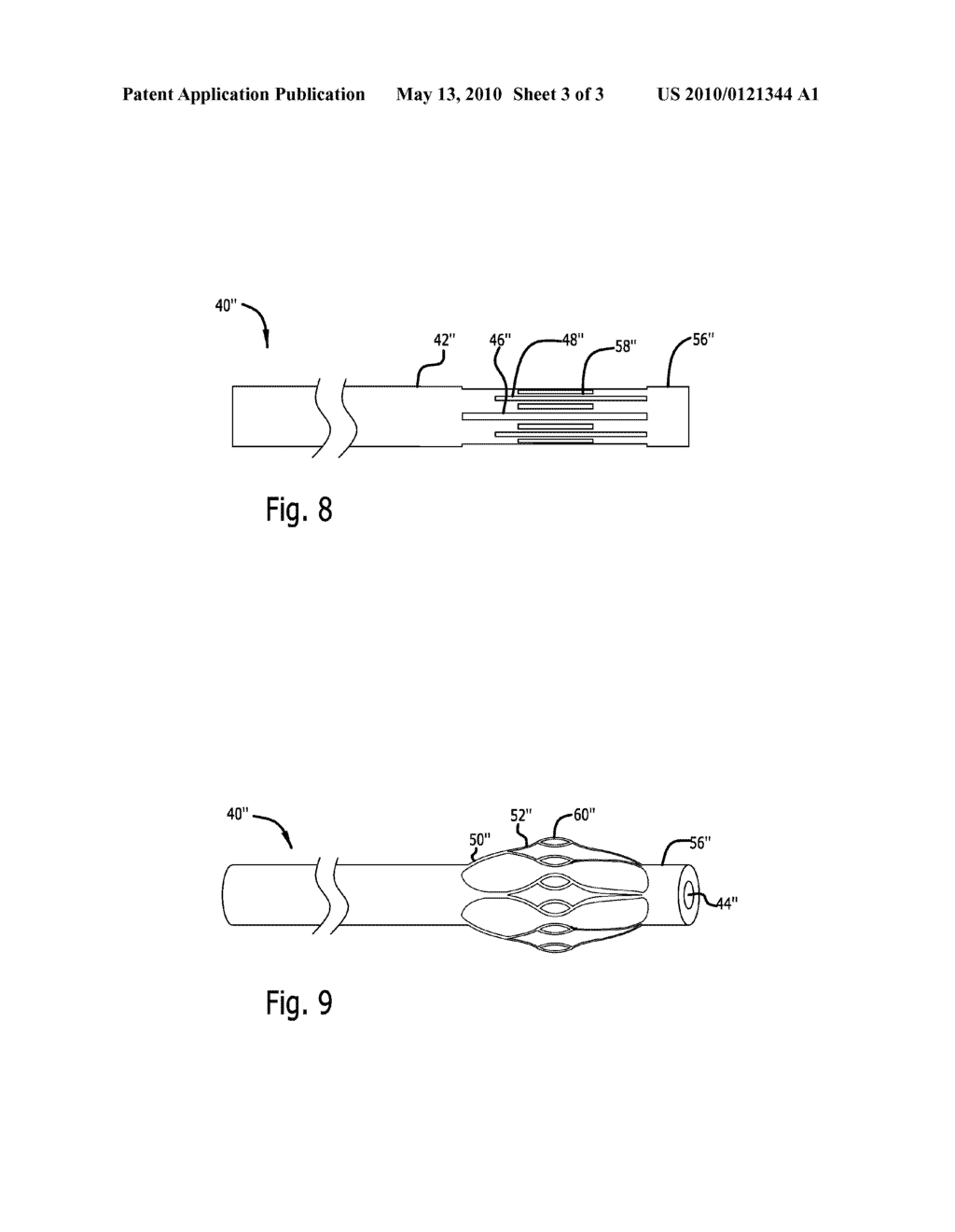 TOOL FOR REMOVING OBJECT FROM THE BODY OF A PATIENT - diagram, schematic, and image 04