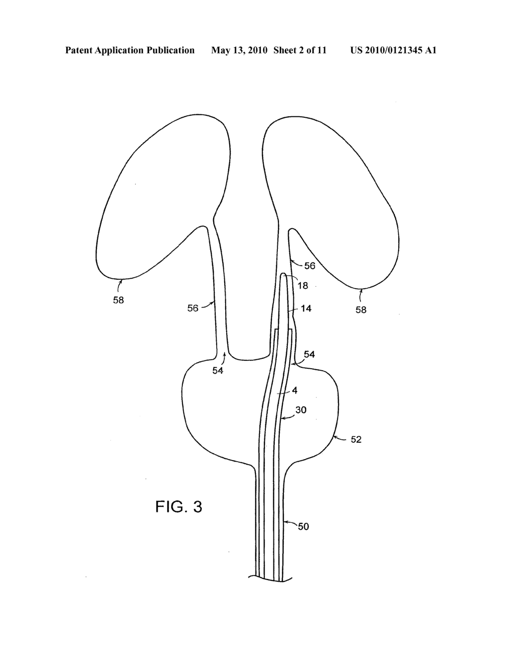 DILATOR WITH EXPANDABLE MEMBER - diagram, schematic, and image 03