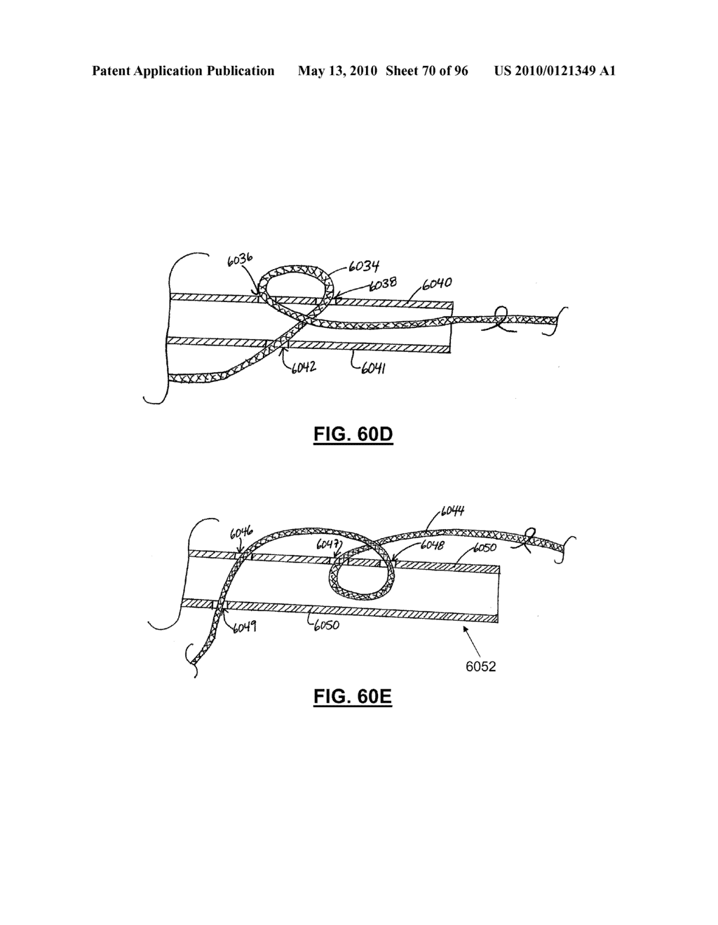 TERMINATION DEVICES AND RELATED METHODS - diagram, schematic, and image 71